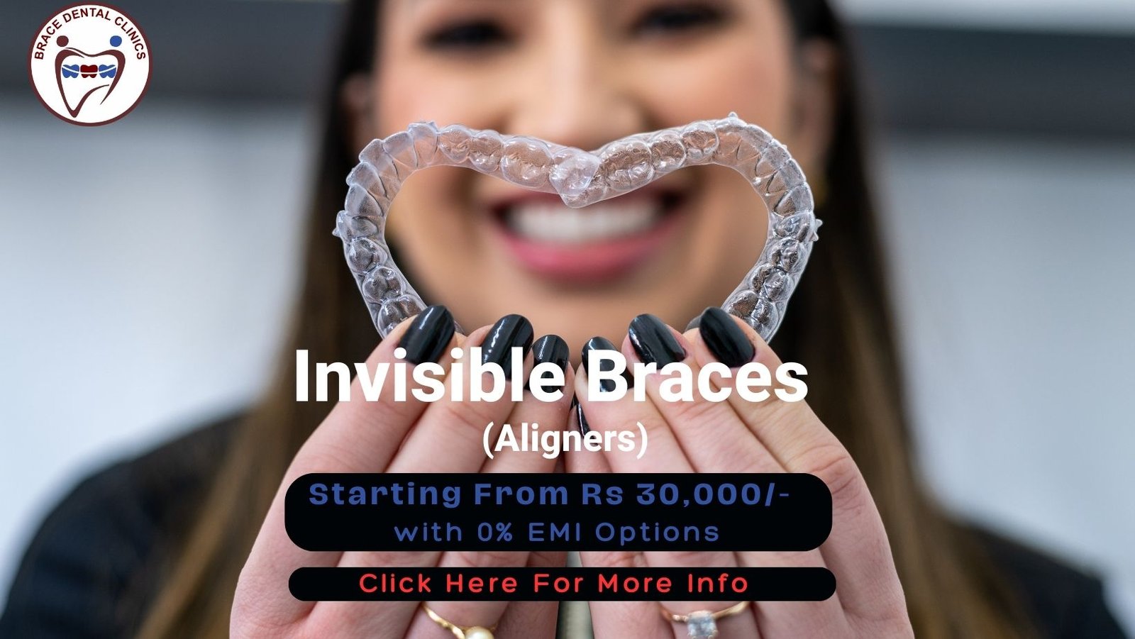 Best Invisible Braces In Hyderabad