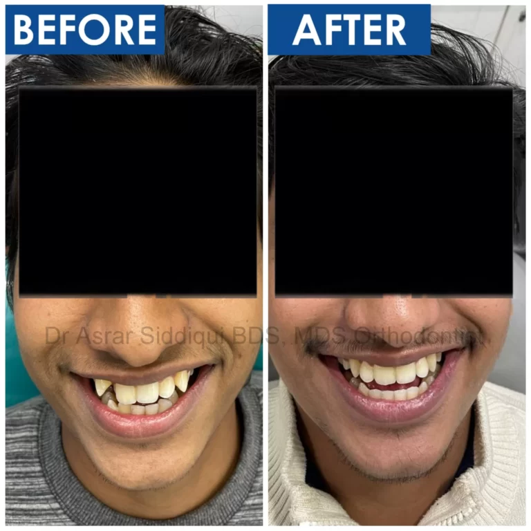 Dr Asrar Siddiqui, Brace Dental Clinic
