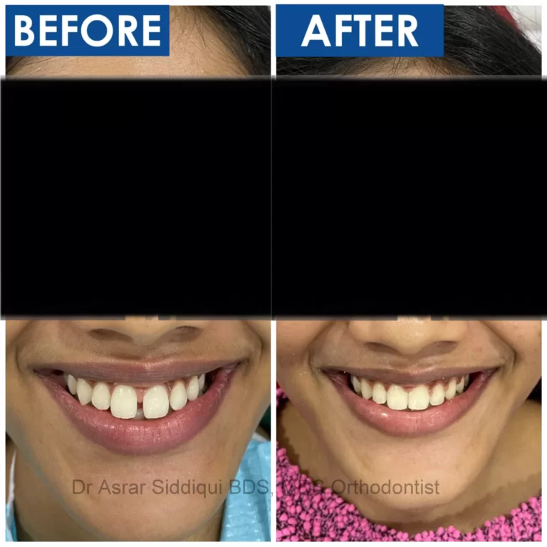 toothys dental , Dr Asrar Siddiqui