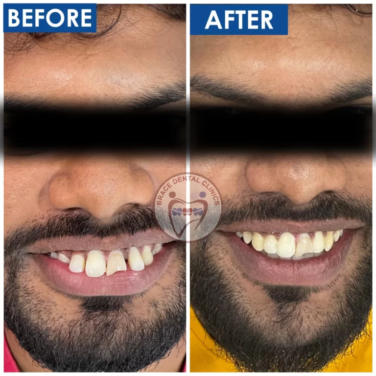 Dr Asrar Siddiqui, Top Orthodontist in Hyderabad