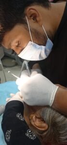 Fixed Partial Denture (FPD) - Brace Dental