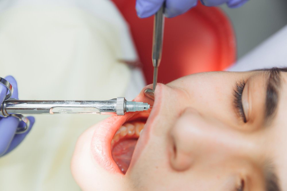 Painless Tooth Removal in Hyderabad