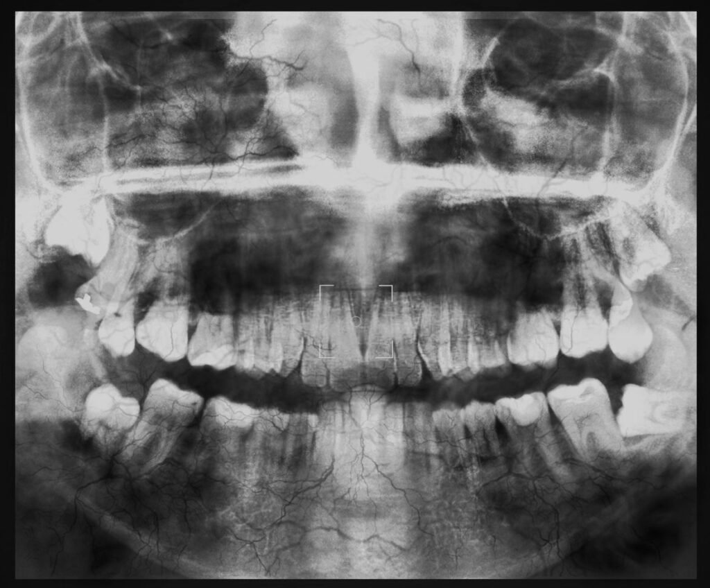 why do i have jaw pain? Brace Dental Clinic