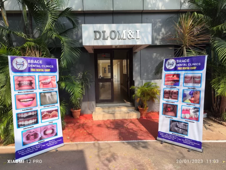 DLOMI Hyderabad, Brace Dental Clinic