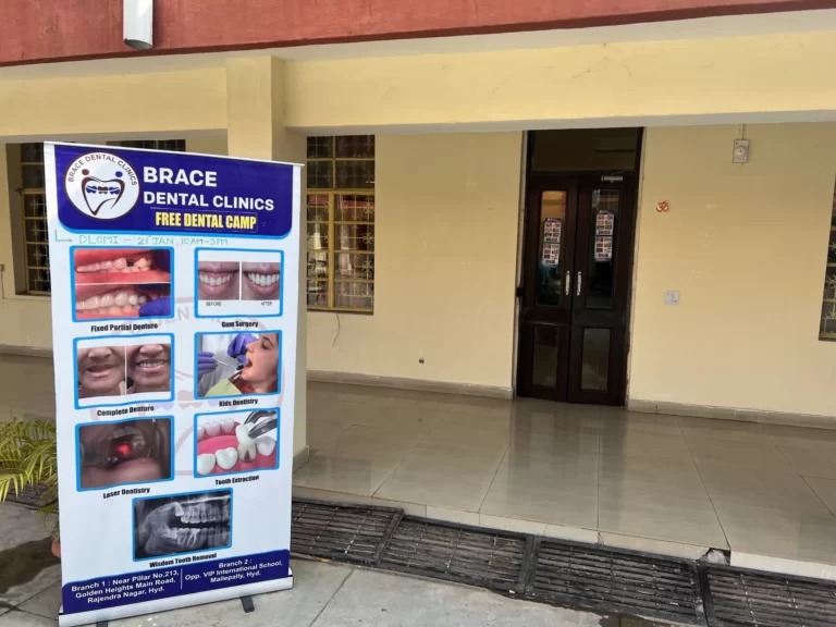 DLOMI Hyderabad, Brace Dental Clinic