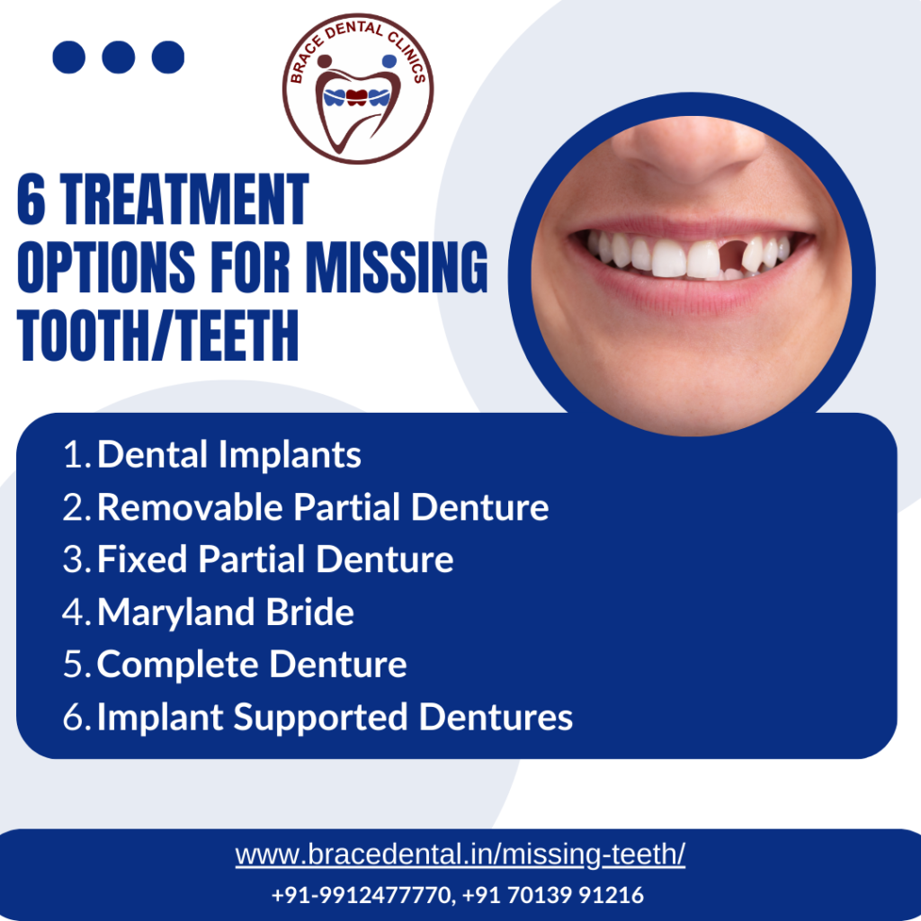 treatment for missing tooth