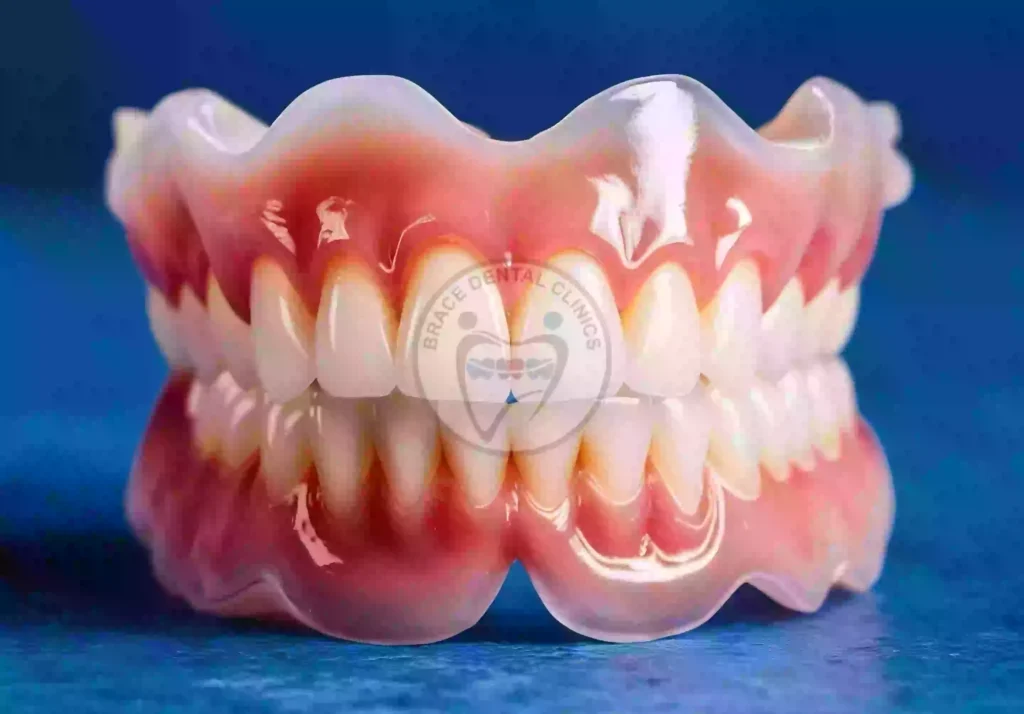 Best Dentures in Secunderabad